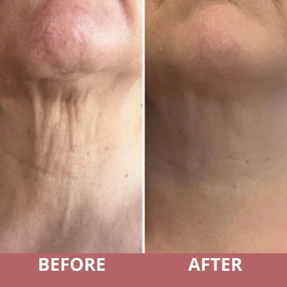 NeckLuxe Renewal Cream